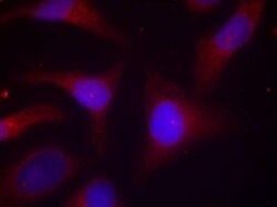 IkB-alpha, p Ser32, p Ser36 Antibody, Novus Biologicals 0.025 mL; Unconjugated:Antibodies,